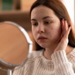 How to Reduce the Look of Pores on Face?