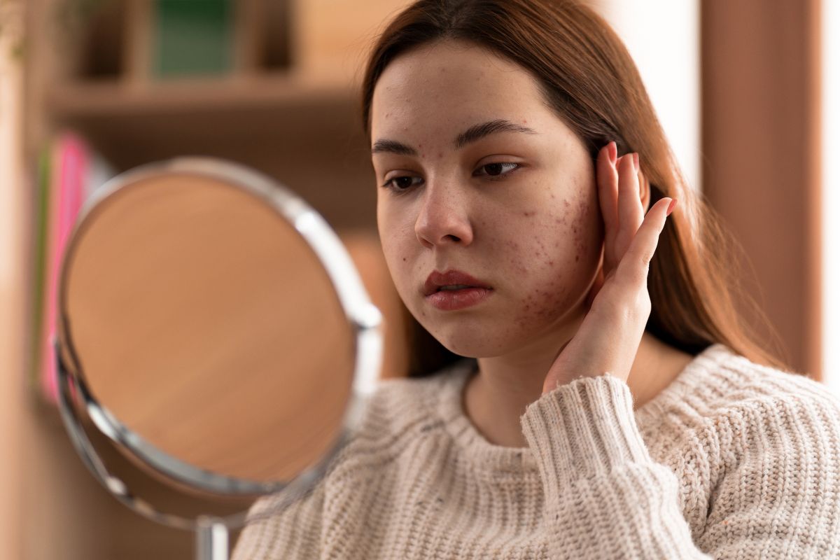How to Reduce the Look of Pores on Face?